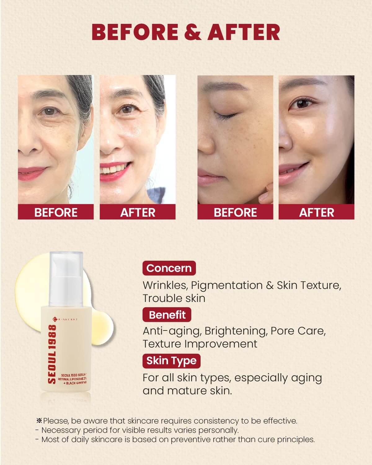 ksecret seoul 1988 Serum Retinal 2% si Ginseng negru